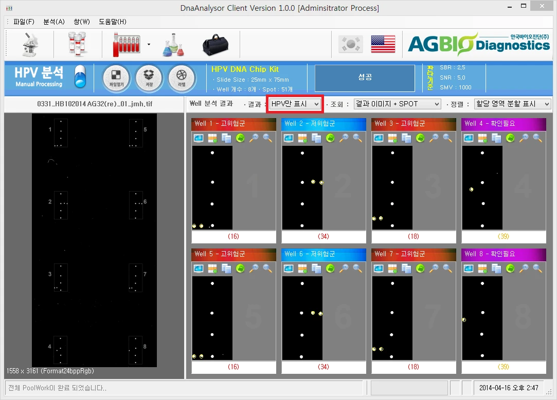 [Dnaanalysor] Spot Auto Positioning 및 이미지 Processing , Reprot Export(csv , xps)
<br>HPV DNA Chip의 검사 후 진단에서 판독기준에 따라 자동으로 판독하여 고객의 편의성을 높이고 판독의 오류를 막음
<br> ㆍ개발언어: Microsoft .Net Framework 4.0(C# Winform - Client Profile 환경)
 ㆍ개발툴: Visual Studio 2012 SP 1
 ㆍ개발시기: 2014. 1 ~ 2014. 3
<br>