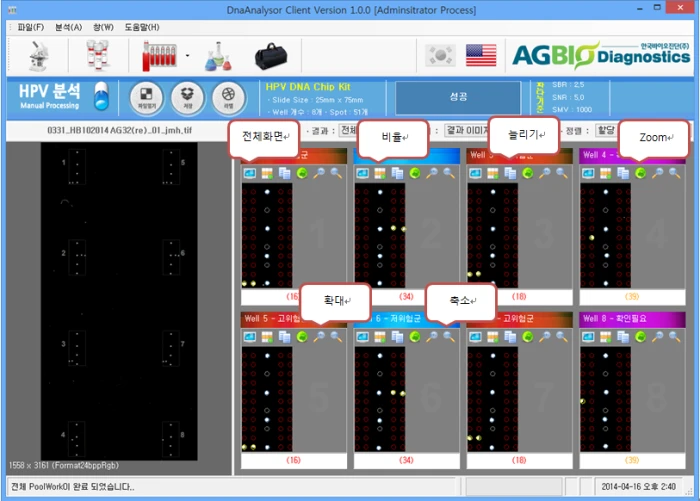 [Dnaanalysor] Spot Auto Positioning 및 이미지 Processing , Reprot Export(csv , xps)
<br>HPV DNA Chip의 검사 후 진단에서 판독기준에 따라 자동으로 판독하여 고객의 편의성을 높이고 판독의 오류를 막음
<br> ㆍ개발언어: Microsoft .Net Framework 4.0(C# Winform - Client Profile 환경)
 ㆍ개발툴: Visual Studio 2012 SP 1
 ㆍ개발시기: 2014. 1 ~ 2014. 3
<br>