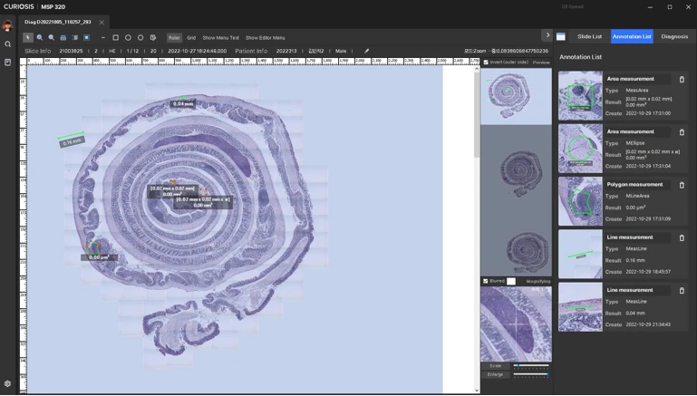 큐리오시스 -디지털병리(Image registration/stitching viewer)